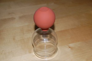 Schröpfen